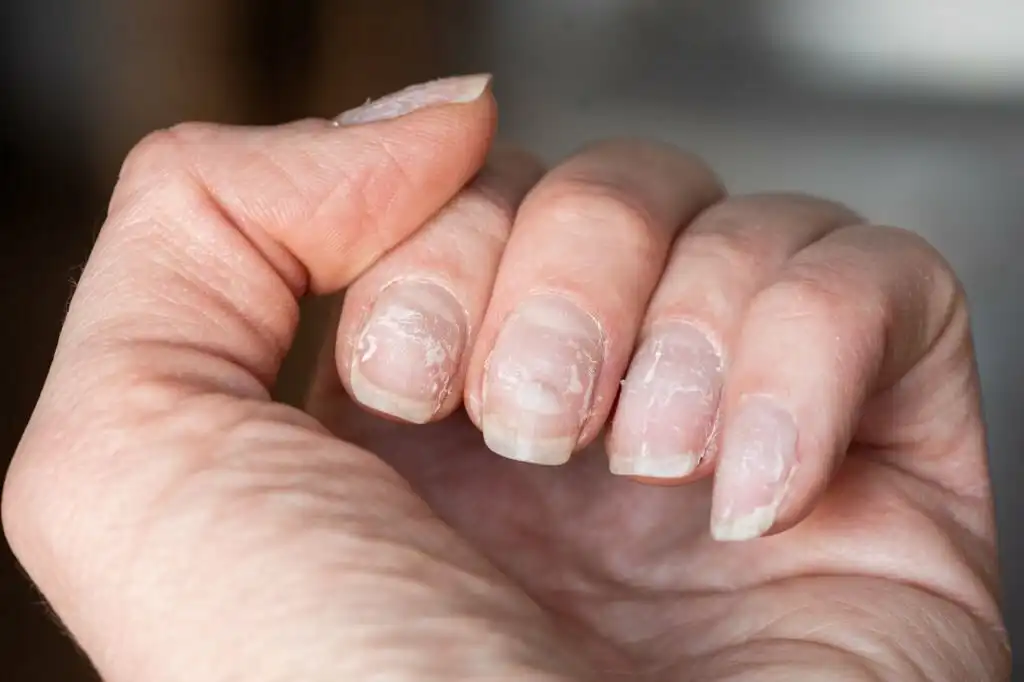 Nail-Treatments-Unit